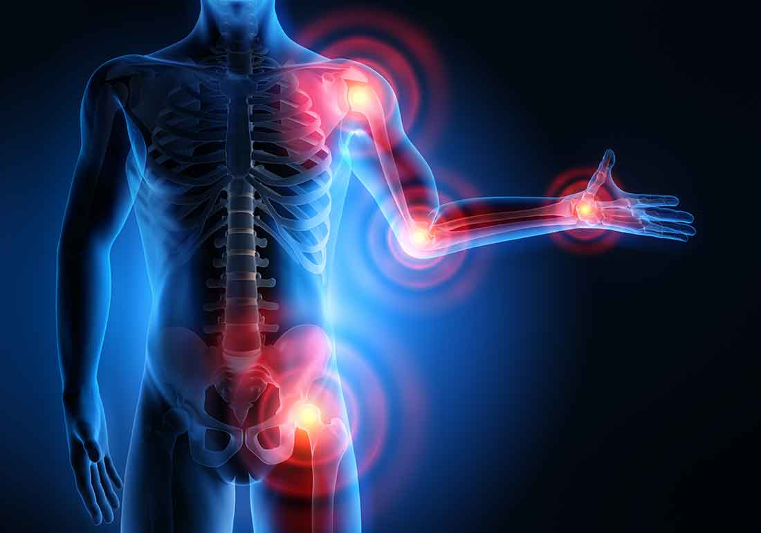 Darstellung von Schmerzen in Schultergelenk und Becken - Arthrosetherapie Kolbermoor